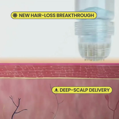 Mikro Re:Grow 30-Day Hair Regrowth System